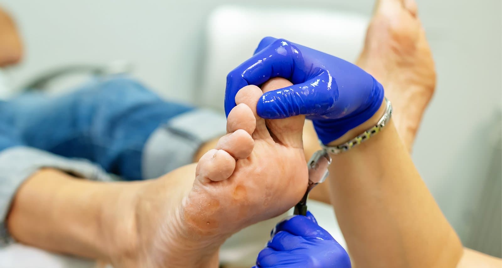 Diabetes Foot Care