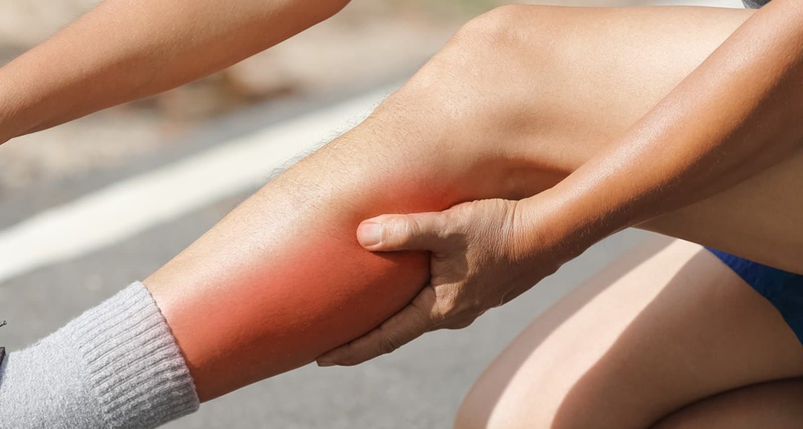 Shin Splints