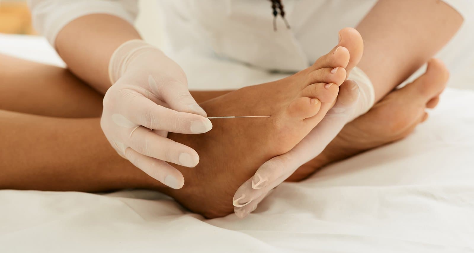 Dry Needling